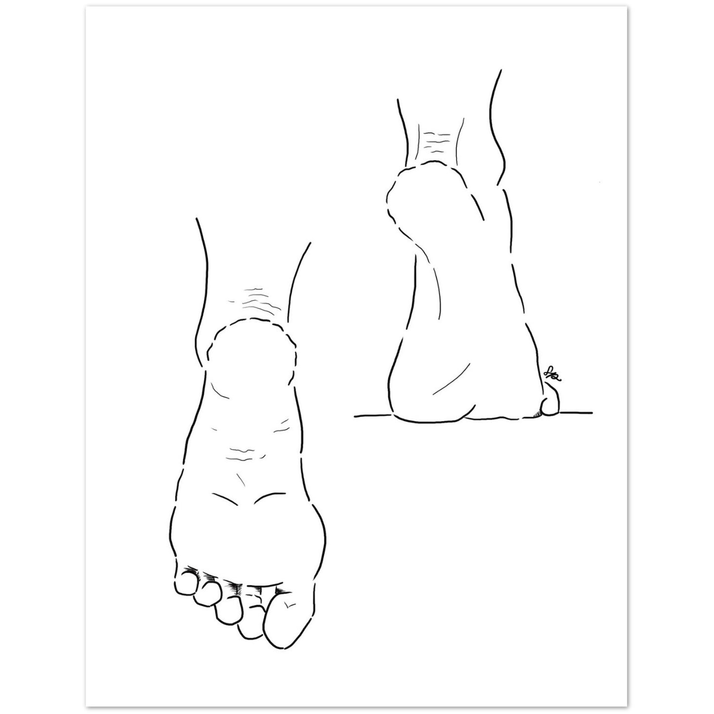 Line drawing of a foot and leg on a white background